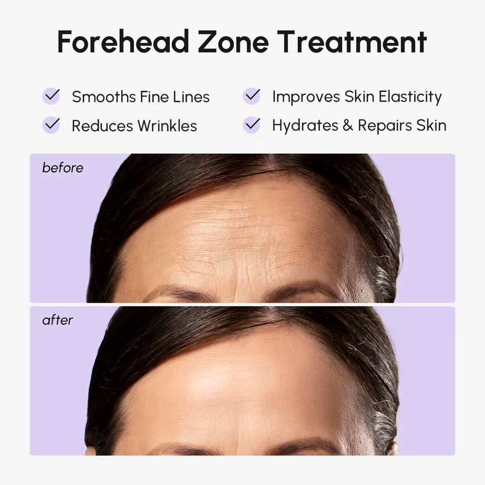 Anti-Wrinkle Forehead Patches